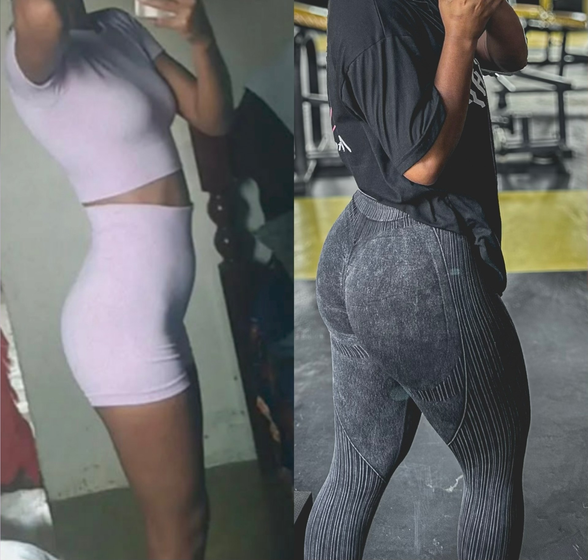 Antes e depois: Evolução de glúteos e membros inferiores
