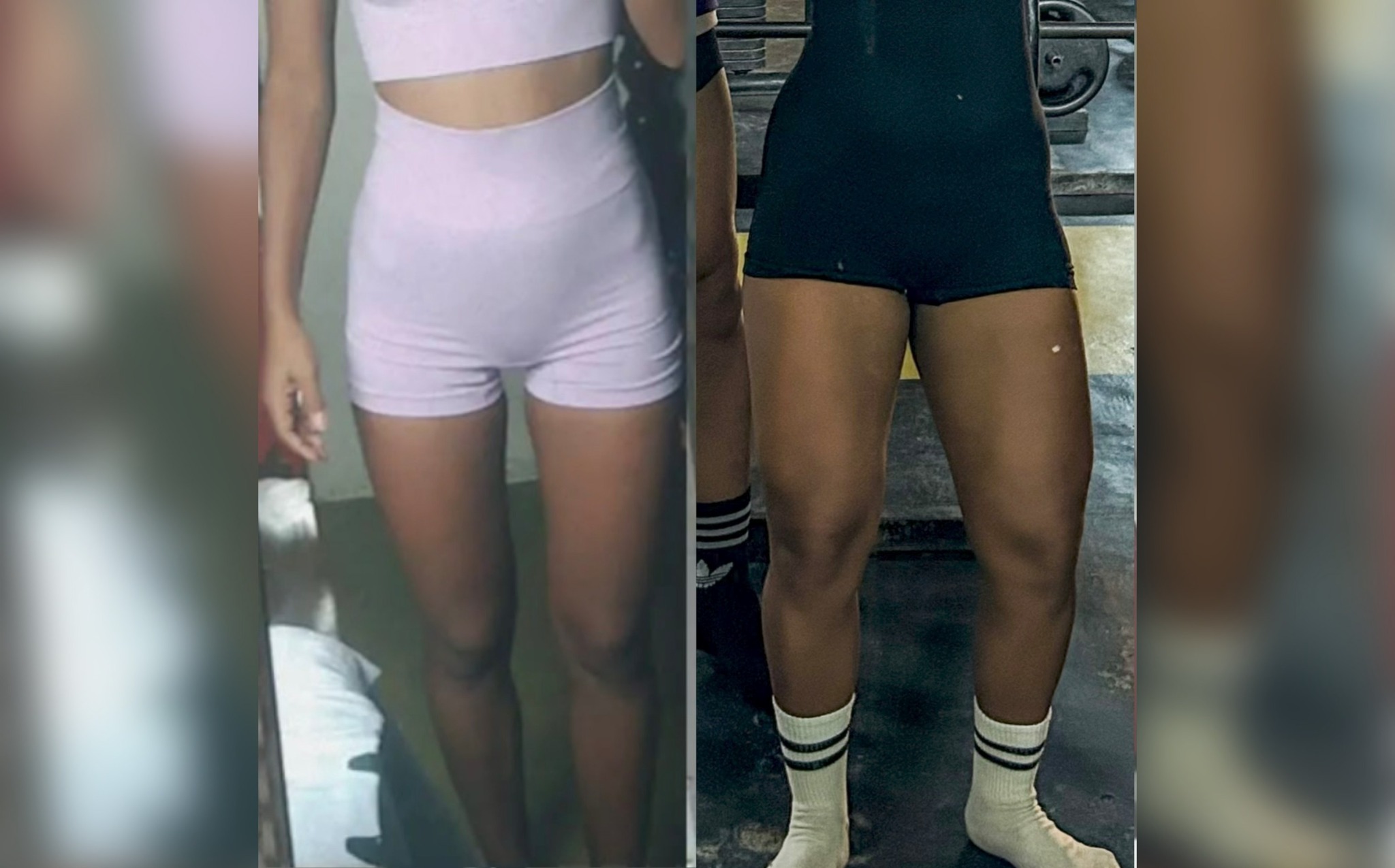 Antes e depois: Evolução de membros inferiores