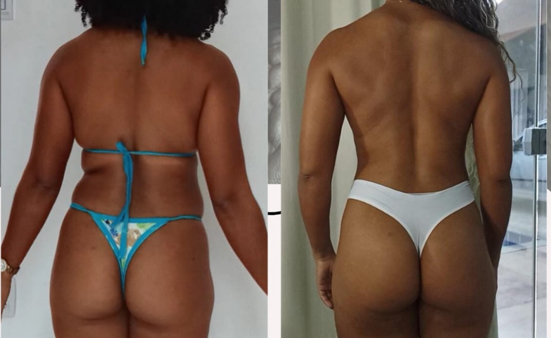 Antes e depois: Evolução corporal posterior